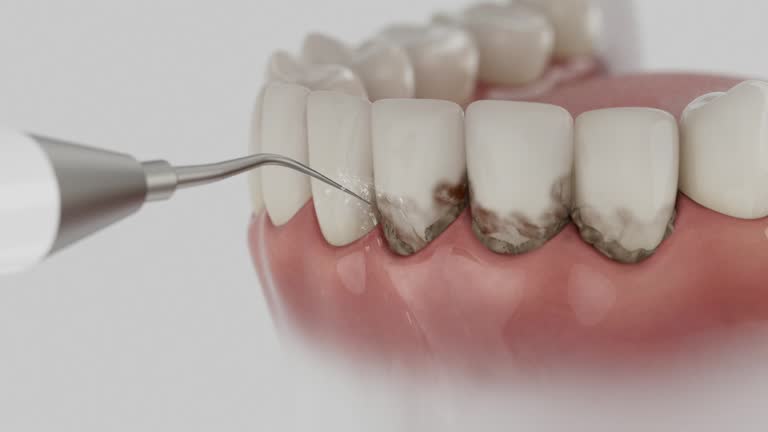 Trusted Dental Implants service in White Bear Lake, MN - Dentist Open Now